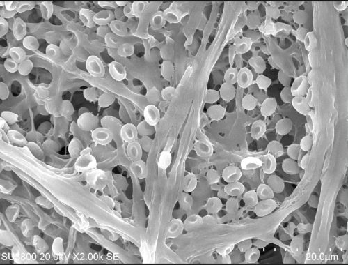 fungus